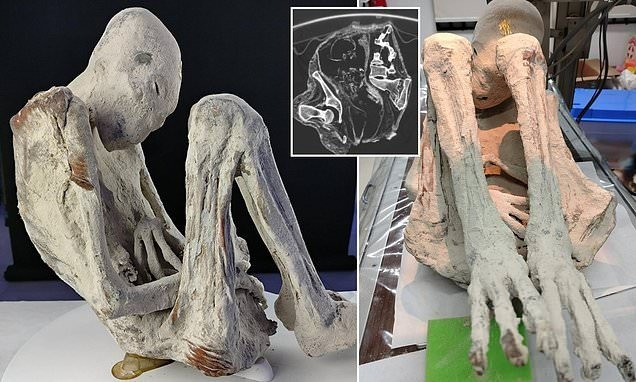 Nhóm nghiên cứu gọi xác ướp Montserrat là "tridactyl" vì bàn tay, bàn chân có ba ngón. Đây là một đặc điểm bất thường đã làm dấy lên suy đoán rằng đó là người ngoài hành tinh hoặc bò sát. Ảnh: Jois Mantilla/Tridactyls.org. ba-7.jpg