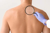 Phòng ung thư da, lão hóa sớm từ bên trong